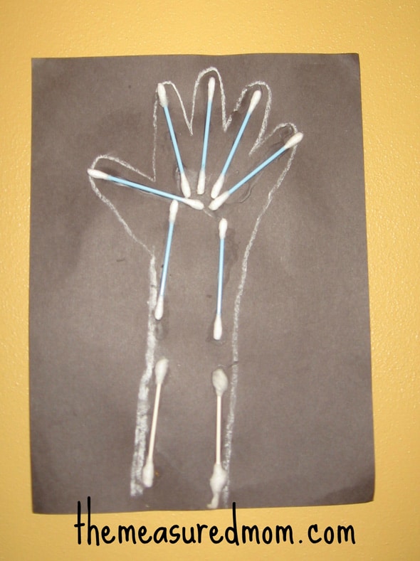 Q-tip X射线字母X